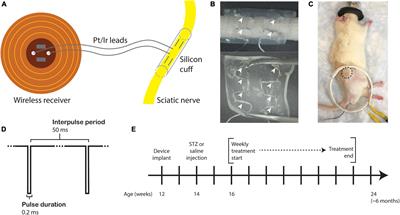 Neuroskeletal Effects of Chronic Bioelectric Nerve Stimulation in Health and Diabetes